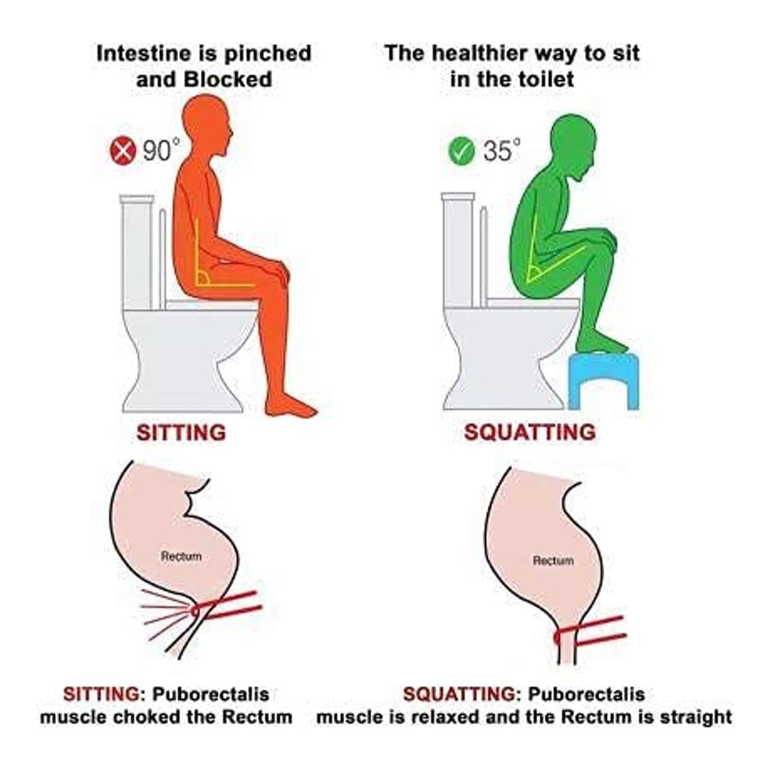 6005A પ્લાસ્ટિક નોન-સ્લિપ ફોલ્ડિંગ ટોઇલેટ સ્ક્વોટ સ્ટૂલ - સફેદ રંગ