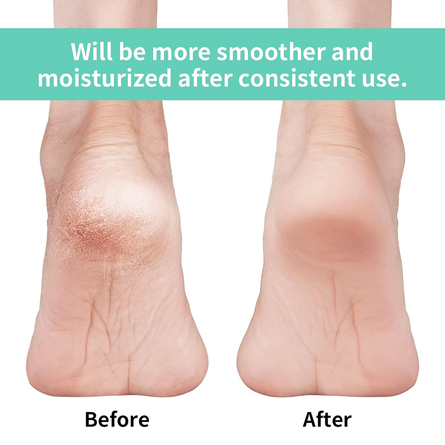 एंटी क्रैक सिलिकॉन जेल हील मॉइस्चराइजिंग सॉक्स पैरों की देखभाल के लिए पुरुषों महिलाओं के लिए (ढीला पैक)