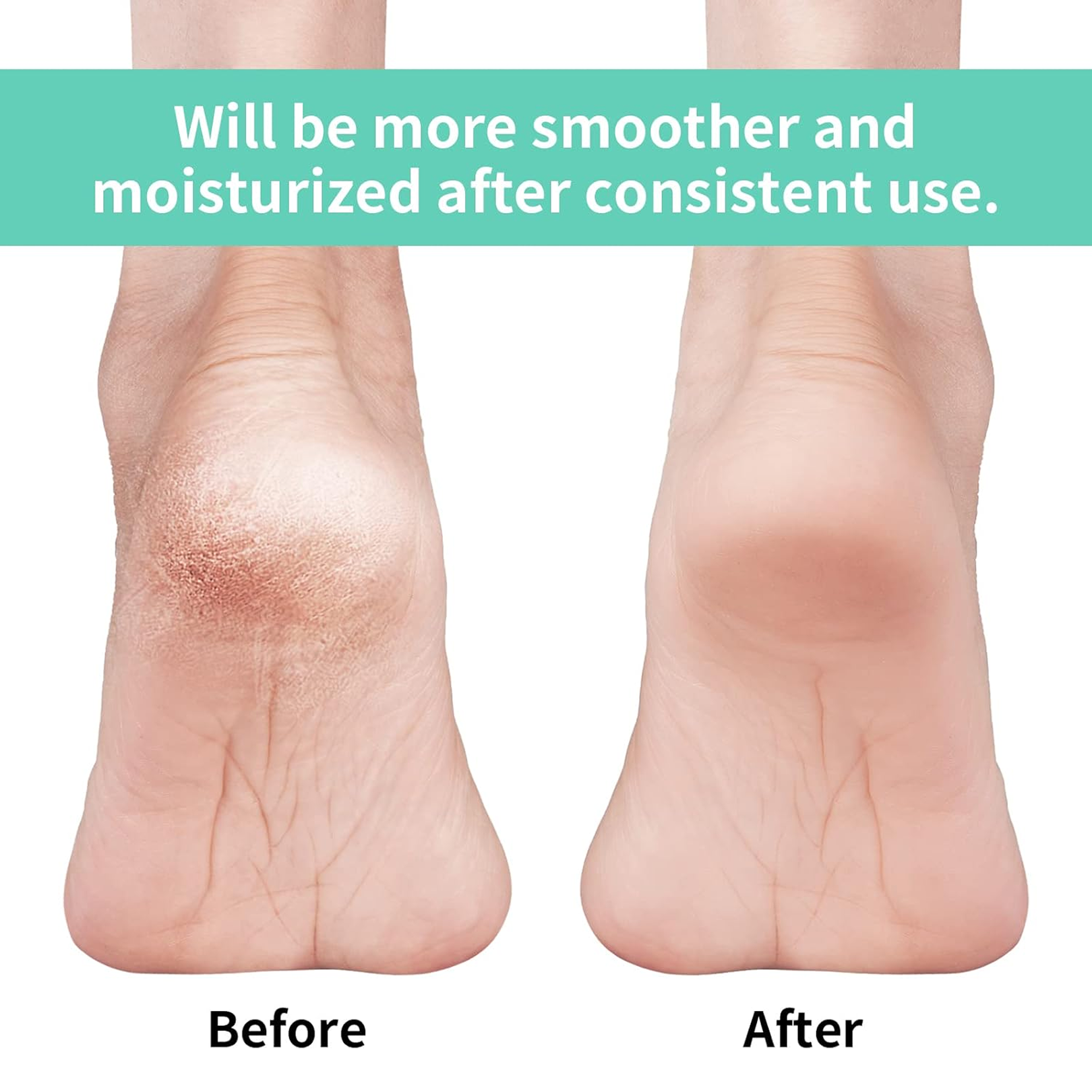 एंटी क्रैक सिलिकॉन जेल हील मॉइस्चराइजिंग सॉक्स पैरों की देखभाल के लिए पुरुषों महिलाओं के लिए (ढीला पैक)