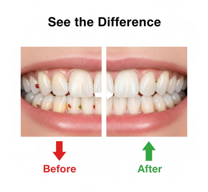 Smart Water Flosser Teeth Cleaner For Cleaning Teeth