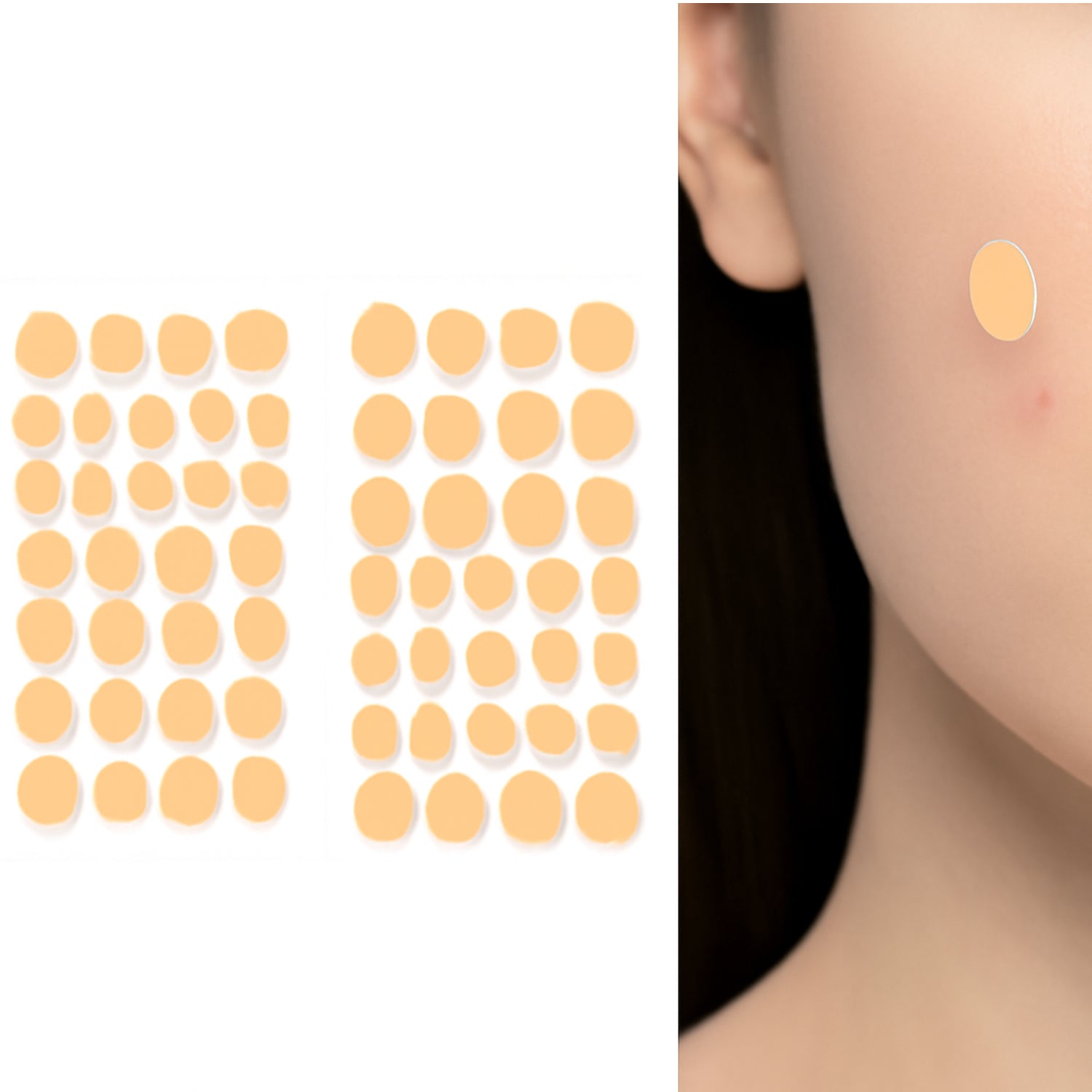 Pimple Patches for Face (2 Sheet Set)