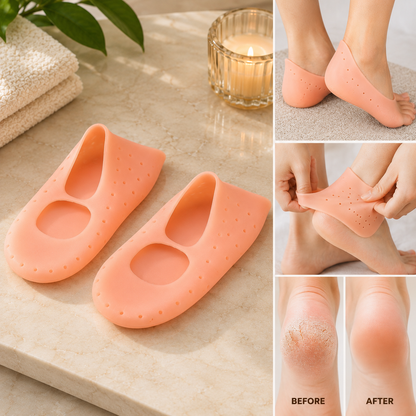Cracked Heel Socks – Moisturizing Silicone Gel for Foot Care | FitFuzion