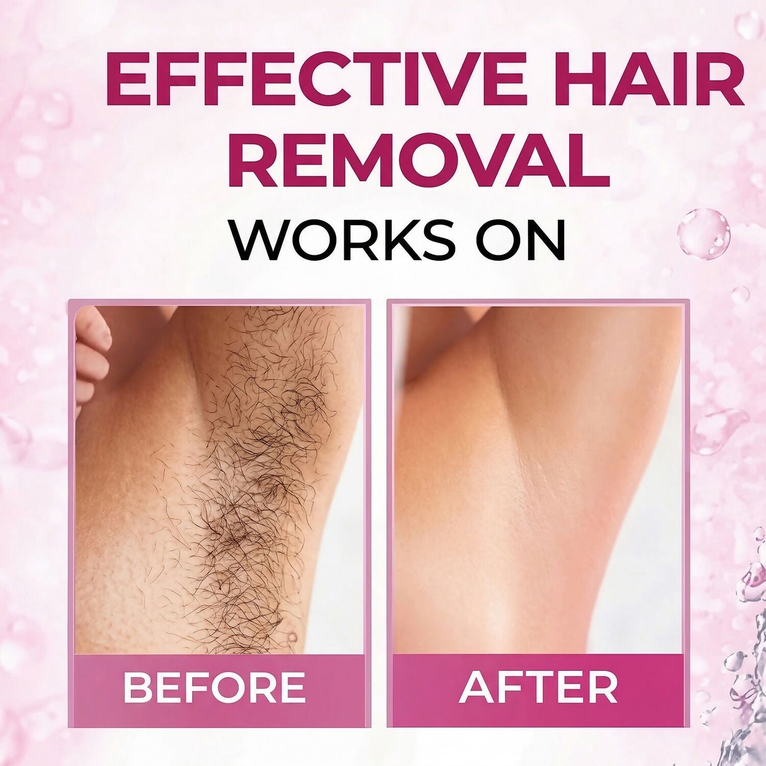 Women Hair Removal Spray Smooth Skin Fast Action Aloe Vera Formula (50 Ml)