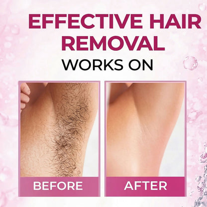 Women Hair Removal Spray Smooth Skin Fast Action Aloe Vera Formula (50 Ml)