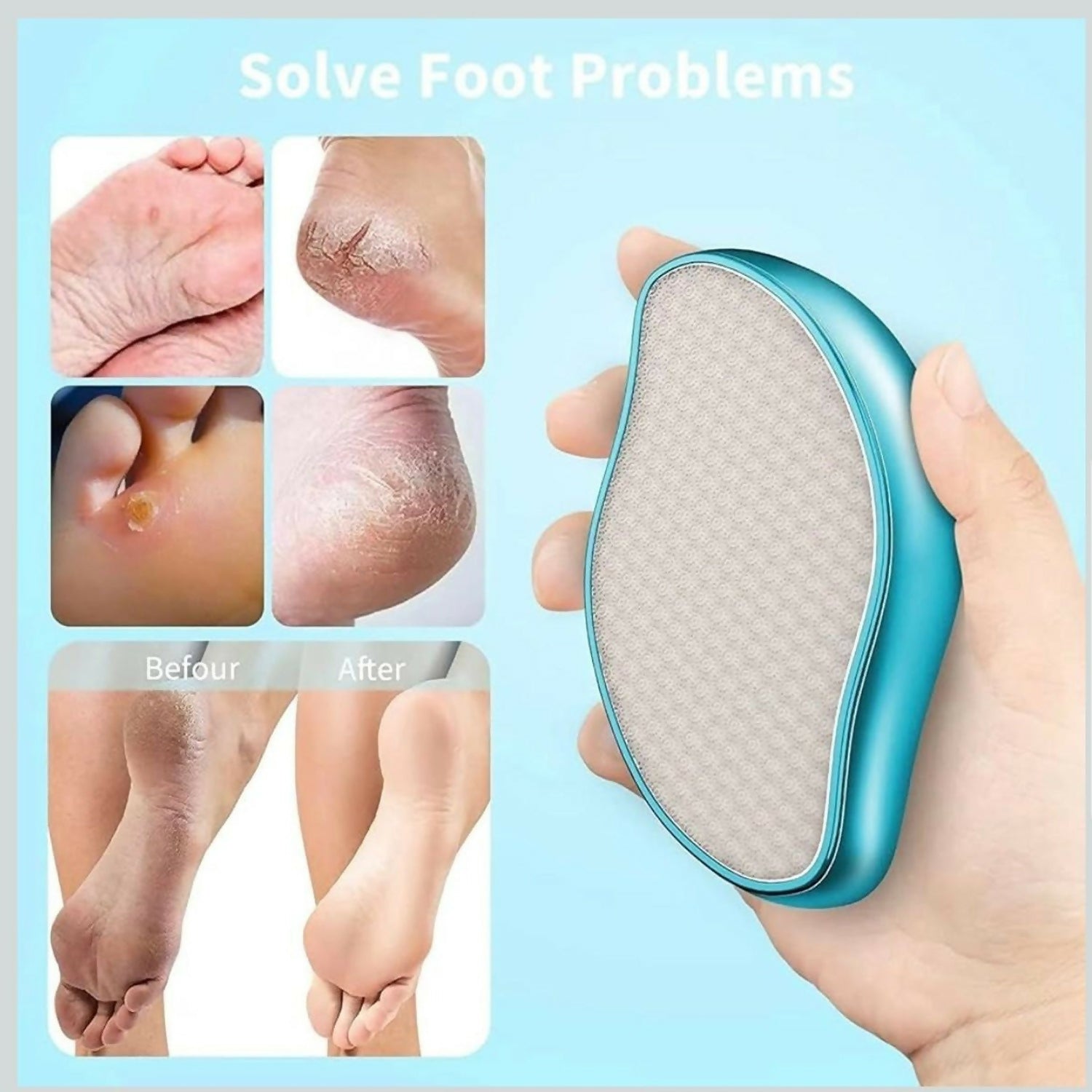Reusable Foot Care Scrubber for Callus Removal and Smooth Skin Maintenance(ANYCOLOR)